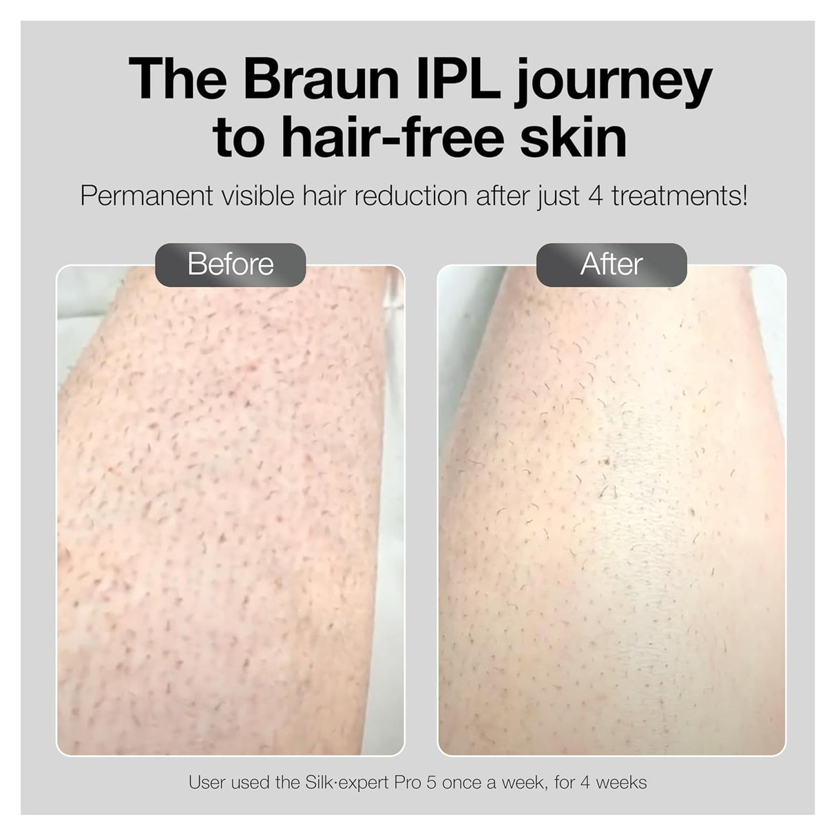 BRAUN IPL Silk-Expert Pro 3 IPL3221