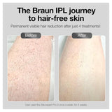 BRAUN IPL Silk-Expert Pro 3 IPL3221